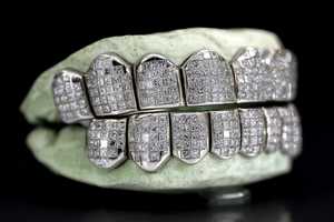 Grillz Dentales de Plata 925 con Corte Princesa, Escaneo Dental 3D, Proceso Rápido, Personalizados, Invisibles, con Incrustaciones de Diamantes VVS Cultivados en Laboratorio, Venta al por Mayor - Product Image 3