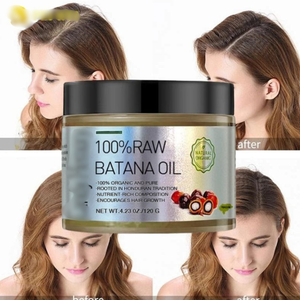 Aceite de Árbol de Té Batana 100% Puro y Sin Refinar, 1.000 kg, Aceite Nutritivo Natural para el Crecimiento del Cabello, Cabello Más Fuerte, Contra la Caída del Cabello - Product Image 2
