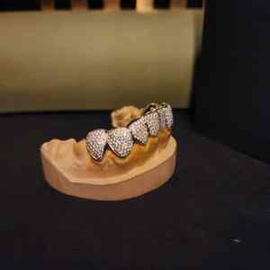 Ensemble de grillz en diamant avec pavé complet en argent sterling 925, bijoux de bouche pour rappeur hip-hop - Product Image 5