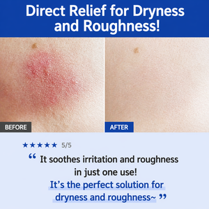 Tónico Facial de Hidratación Profunda, Calmante, Refrescante, Cuidado de la Textura para Piel Seca y Sensible, Apoyo a la Barrera Cutánea - Product Image 5