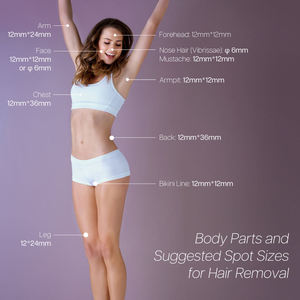 Winkonlaser - Depiladora Láser de Diodo con Tamaño de Punto Dinámico, 4 Longitudes de Onda, 808nm, Precio de la Máquina de Depilación Láser de Diodo - Product Image 6