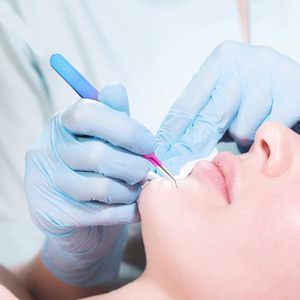 Lot de 3 pinces à points noirs en acier inoxydable, extracteurs de boutons, pinces courbées pour éliminer les comédons et les points blancs, soins de la peau - Product Image 6