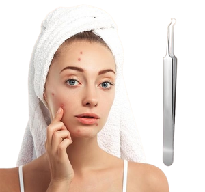 Outils de soin de beauté : Pince à épiler pour l'acné, l'élimination des points noirs et des boutons, et pince à épiler pour extensions de cils - Product Image 2