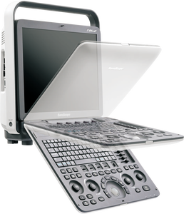 SonoScape S8 ExpV - Sistema de Ultrasonido Doppler Color Digital Portátil y Duradero, Escáner Veterinario Sonoscape para Clínica y <span class=keywords><strong>Hospital</strong></span> - Product Image 3