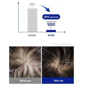 Champú de Espuma Coreano para Cabello Fino, Prevención de la Caída del Cabello, Herbal Anticaspa, Exfoliante, Reparador, Equilibrio del Cuero Cabelludo, Cuidado Unisex SMIB High - Product Image 2