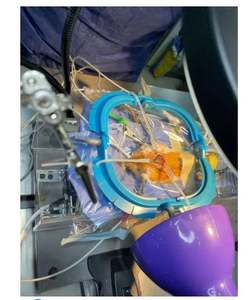 Système d'opérations chirurgicales urologiques réutilisable : Anneaux et crochets de haute qualité, ensemble de rétracteurs manuels Lone Star - Product Image 5