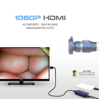 Camjoy CY-FHD 1080p HD Endoscope médical USB pour diagnostic ORL animal et injection, certifié CE ISO, usage chirurgical hospitalier