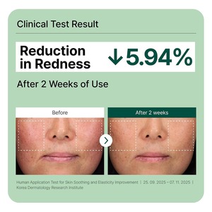 Crema Facial Coreana con Certificación Halal TAE743 Gamtae Exosome, Hidratante para Piel Sensible y con Tendencia a Enrojecimiento, Antioxidante, Caja de 30 ml - Product Image 6