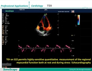 Dispositif de sonscope à ultrasons <span class=keywords><strong>S22</strong></span> TDI CW Mode, Doppler couleur numérique, 4 douilles de sonde, Machine d'ultrasons pour hôpital - Product Image 5