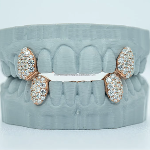 Custom 2 Top 2 Bottom S925 Plata Solid Gold Plated D VVS Moissanite Diamond 100% Passed Diamond Tester Dientes Grillz - Product Image 1