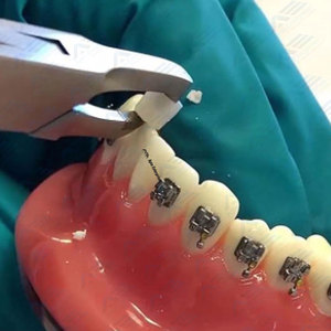 Pince à décoller le ciment des bagues orthodontiques, instruments médicaux, outil de retrait des appareils dentaires chirurgicaux, instruments chirurgicaux - Product Image 6