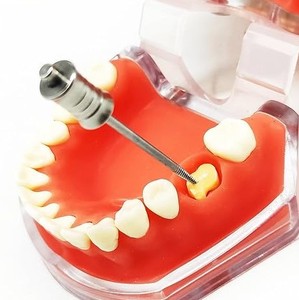 Juego de Instrumentos Quirúrgicos Manuales de Alta Calidad para Extracción Dental, para Uso en Clínicas y UCI, Venta Directa de Fábrica - Product Image 4