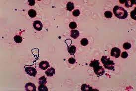 โปรไบโอติกที่ดีที่สุดสำหรับเชื้อจุลินทรีย์สเตรปโตโคคัส ซาลิวาเรียส - Product Image 2