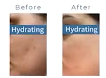 Aribell Aqua Hydrating Ampoule Salmon DNA PN Hyaluronic Acid Serum pour l'élasticité de la peau, soin coréen professionnel pour la peau, 4 ml - Product Image 5