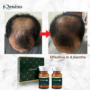 2025 Renéxo Popular Deer Antler Hair Growth Essence Serum con péptidos Taiwán OEM Productos OEM Tónico para el cuidado del cabello con células madre - Product Image 2