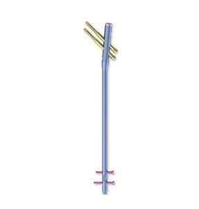 Système d'onglets intramédullaires orthopédiques multifonctionnels en acier inoxydable pour fémur - Product Image 6