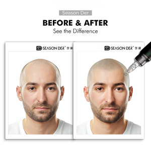 Peau d'entraînement personnalisée en <span class=keywords><strong>cuir</strong></span> SMP pour la micropigmentation du <span class=keywords><strong>cuir</strong></span> <span class=keywords><strong>chevelu</strong></span> et la formation au <span class=keywords><strong>tatouage</strong></span> capillaire - Product Image 6