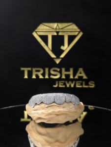 Grillz de luxe personnalisés sertis de diamants de laboratoire VVS, fabriqués en argent sterling 925, bijoux hip-hop - par Trisha Jewels - Product Image 6