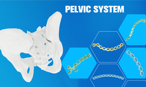 Conjunto de Instrumentos Ortopédicos para Cirugía, Certificación CE ISO, Conjunto de Instrumentos Maxilofaciales, Equipo Médico - Product Image 5