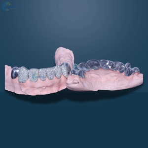 Juego de grillz de lujo con 8 diamantes cultivados en laboratorio (8 superiores y 8 inferiores) en oro blanco macizo de 10K, estilo hip hop para hombres. - Product Image 5