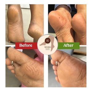 Crème de soin des pieds à base de plantes Nature Essence pour adultes, prévenant les pieds secs et gercés, étiquette privée, vente en gros OEM/ODM - Product Image 5