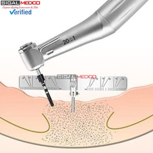 Règle de mesure pour implants dentaires, guide de localisation, localisateur de positionnement chirurgical, jauge d'angle, autoclavable, en acier inoxydable, manuel - Product Image 6