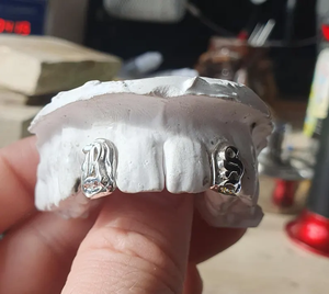 Grillz dentaire plaqué argent massif 925 avec résine bleue, violette et blanche, en contenants, unisexe - Product Image 3
