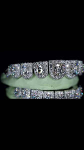 Grillz Moissanite en grappe de fleurs, sertis de grandes pierres, style Hip Hop, en argent sterling 925, ensemble de style soirée - Product Image 1