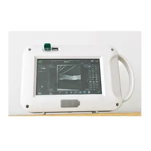 Máquina Handheld de Xray com o detector do tela plano construído no sistema da radiografia de Digitas da máquina do raio do computador x para o hospital