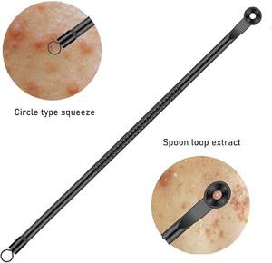 Extractor de Puntos Negros Profesional de Acero Inoxidable de Alta Calidad, Herramienta para Eliminar Puntos Negros - Product Image 2