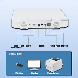 Mesin <span class=keywords><strong>Ultrasound</strong></span> portabel kualitas tinggi mesin dasar Laptop BW pemindai <span class=keywords><strong>Ultrasound</strong></span> peralatan rumah sakit mesin <span class=keywords><strong>Ultrasound</strong></span> untuk manusia - Product Image 4