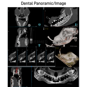 Système de tomodensitométrie conique vétérinaire CT/DR/FL/<span class=keywords><strong>Panoramique</strong></span> 4 en 1, équipement de diagnostic radiologique vétérinaire - Product Image 3