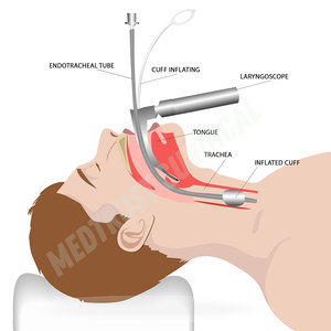Customized Logo Stainless Steel <b>Electric</b> Reusable Laryngoscopes Set Premium Quality ENT Surgery <b>Instrument</b> - Product Image 5