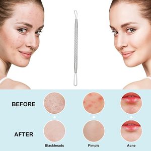 11cm High Carbon Steel Face Comedone <b>Extractor</b> Tool | Professional Double-Ended Acne & <b>Blackhead</b> Remover - Product Image 6
