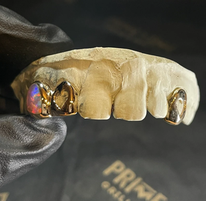 Grillz dentaire en or massif 24K avec incrustation de cœur en opale sertie clos, style hip-hop pour homme, bijou corporel pour usage quotidien - Product Image 4