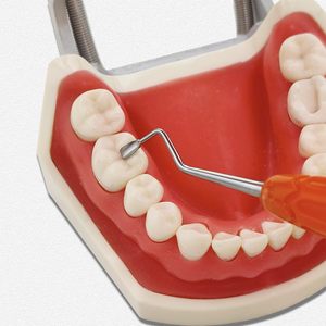 Herramientas Profesionales de Restauración Estética Dental Posterior para Simplificar la Modelación Oclusal de Silicona Dental Posterior - Product Image 5