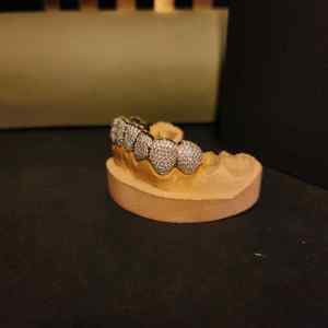 Ensemble de grillz en diamant avec pavé complet en argent sterling 925, bijoux de bouche pour rappeur hip-hop - Product Image 3