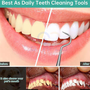 Scalers dentaires de qualité supérieure pour le nettoyage des dents, meilleur prix, instruments de scalage dentaire à usage manuel - Product Image 4