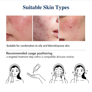 Loción Facial para el Cuidado de Manchas Oscuras, Equilibrio de Grasa y Calma de la Piel con Nicotinamida, Formulación a Granel - Product Image 4