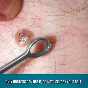 Curetas de oído de piel de zorro de calidad premium con anillas quirúrgicas, instrumento ORL de acero inoxidable para la eliminación segura de cera del oído, profesional - Product Image 6