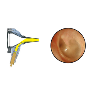 Otoscopio de Fibra Óptica con Cuerpo Metálico Vitra Diagnostics VDA1016 para Uso Clínico y Hospitalario, Certificado ISO13485 CE - Product Image 2