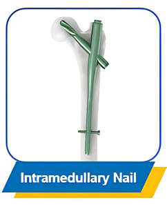 Material de Implante Espinal de Titanio para Tornillo Pedicular Mínimamente Invasivo de Surgiright Instrument - Product Image 4