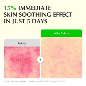 Suero Calmante EQQUALBERRY con Aloe y PDRN - Product Image 3