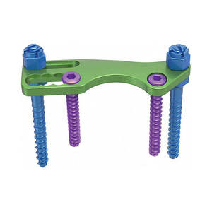 Pin Quirúrgico Frontal de Acero Inoxidable de Doble Acción para Corte y Desbaste, para Ortopedia Veterinaria, de Surgiright Instrument - Product Image 3