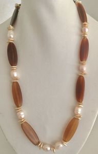 Collar con Colgante de Cuentas de Resina con Diseño de Paz para Mujer, Marca APEX ALIGN, Hecho a Mano, Color Personalizado, Calidad Certificada por Terceros, Ideal para Fiestas - Product Image 3