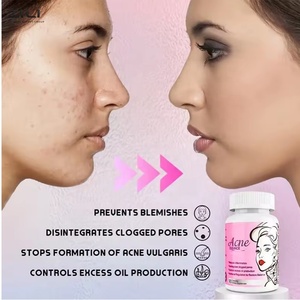 Complément anti-acné pour la peau, capsules végétaliennes contre l'acné, pour peaux grasses, éclaircissant la mélanine, capsules blanchissantes pour la peau - Product Image 5