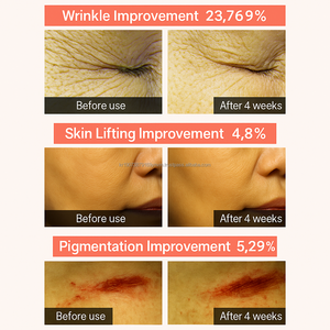 เซรั่มบำรุงผิวหน้า4% บริสุทธิ์บริสุทธิ์จากเกาหลี - Product Image 2