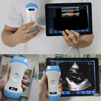 Profesional New Pocket Palm 80 Elements Wireless USG Convex/Linear Phased Probe untuk Iphone dan Ipad