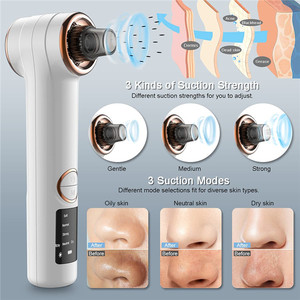 เครื่องดูดสิวเสี้ยนขั้นสูงสำหรับการดูแลผิวหน้าอย่างมีประสิทธิภาพและการทำความสะอาดอย่างล้ำลึก - Product Image 5