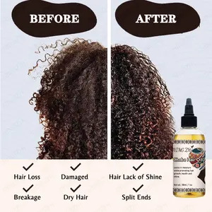 Tratamento para crescimento do cabelo, espessamento e fortalecimento do couro cabeludo, chebe natural e óleo de alecrim, em oferta inteira
